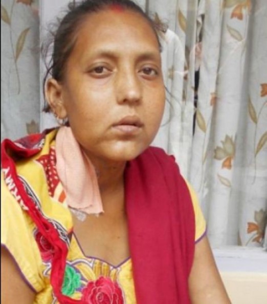 खर्चको अभावले सरिताको मृगौला प्रत्यारोपण हुन सकेन