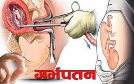 सुरक्षित गर्भपतन सेवाप्रति सकारात्मक बन्दै
