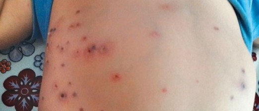 वेब तस्विर 