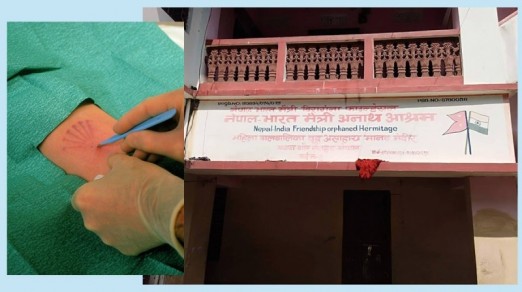 अनाथालयमा राखिएकी १४ बर्षिया बालिकाको शरीरमा परिवार नियोजनको अस्थायी साधन ‘नरप्लान्ट’ भेटियो