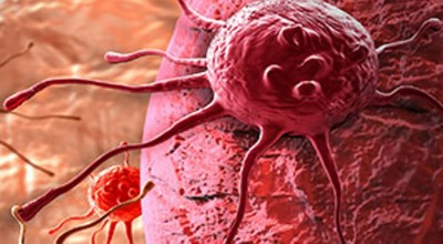 1537888601cancer-1.jpg