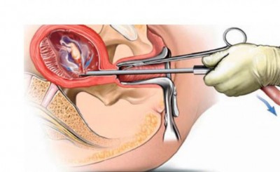 1551020290Garvapatan-710x434.jpg