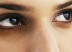 1673256164dark-circle-eye1648787396.jpg