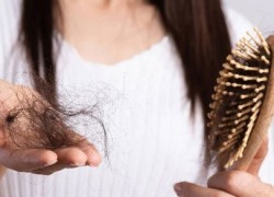 1676195793hair-fall-3.jpg
