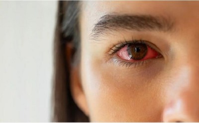 1742980436eye-fluekCmuIG3pKZ.jpg